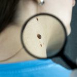 dermatolog Bródno
