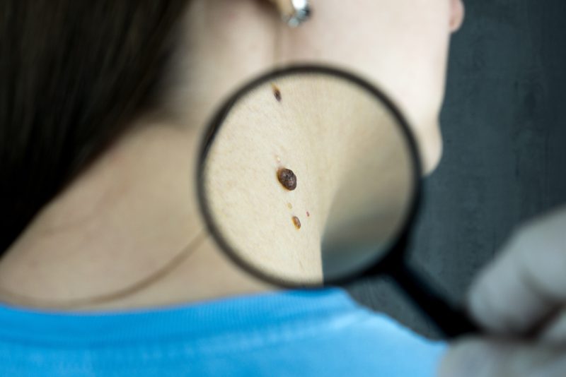 Sprawdzony dermatolog w Warszawie czyli jaki?